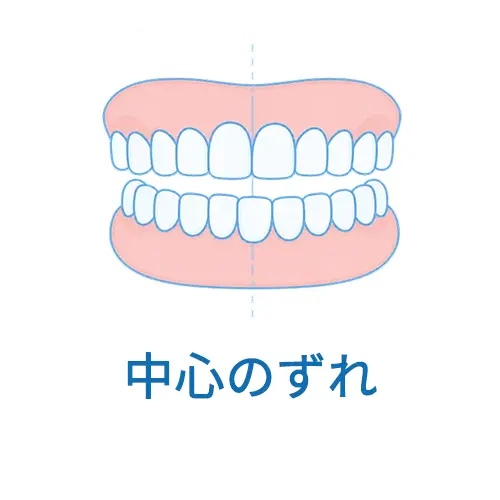中心のずれ